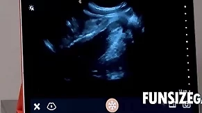 Ultra sound intensively inspection - dr wolf, austin
