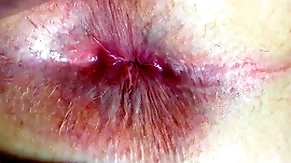 Ass and anus closeup
