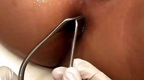 Asian patient penetrated in anal hole by ray in missionary
